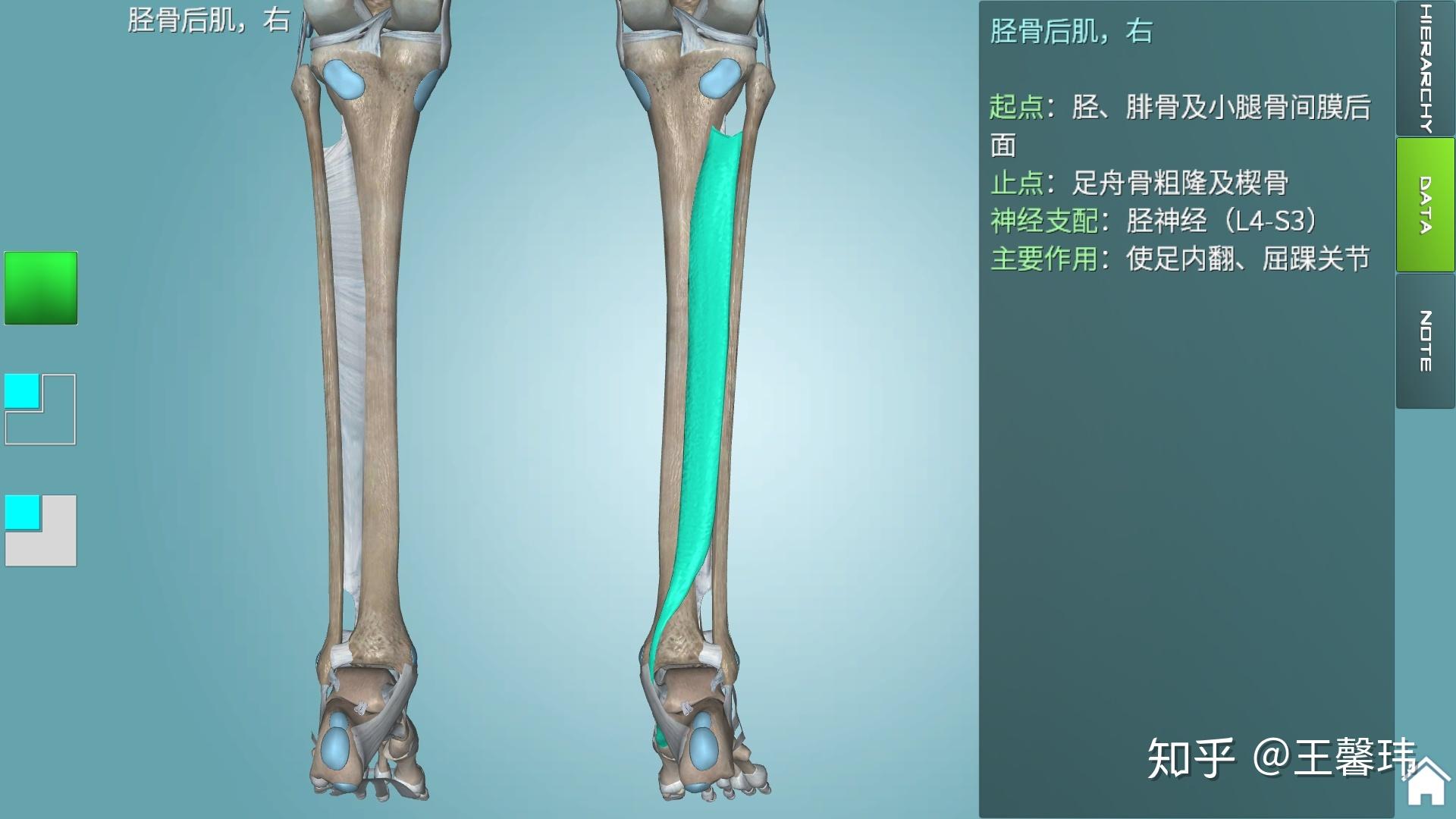 左股骨,股骨骨折,股骨_大山谷图库