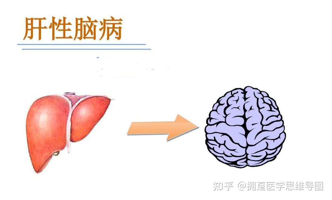 肝性脑病血氨图片