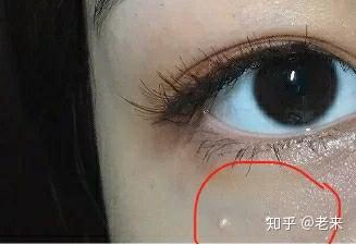 怎么才能不长脂肪粒 v2-eb57634fc3325c0334a95c4206982f1d_b.jpg