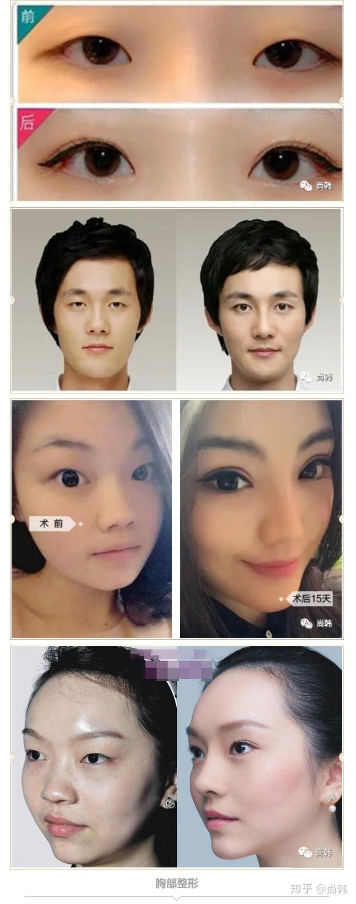 整形前后对比照，给你来一次视觉盛宴 - 知乎