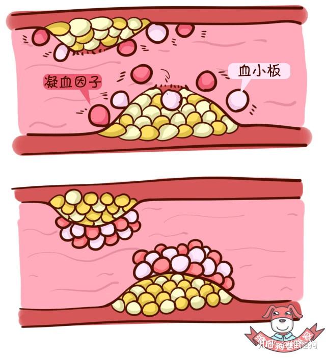 高血压认知2 高血压认知2