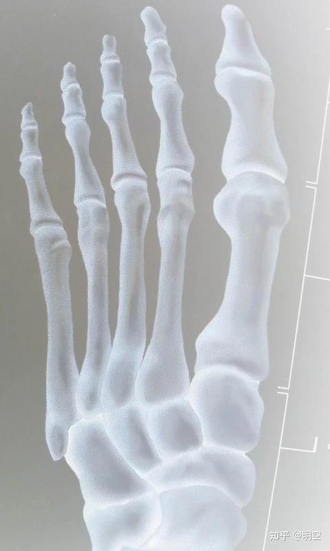 白骨观实修讲解——白骨流光与禅针 - 知乎