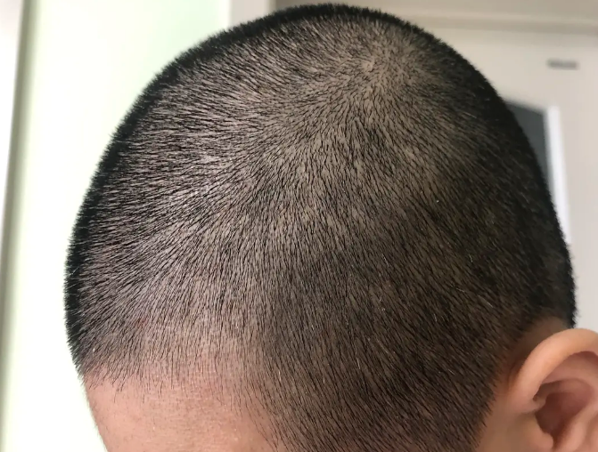 细、软、塌、爱油的头发怎么护理? - 知乎