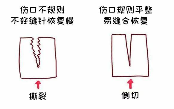 顺产如何避免侧切和撕裂？产后如何护理？一文讲清 - 知乎