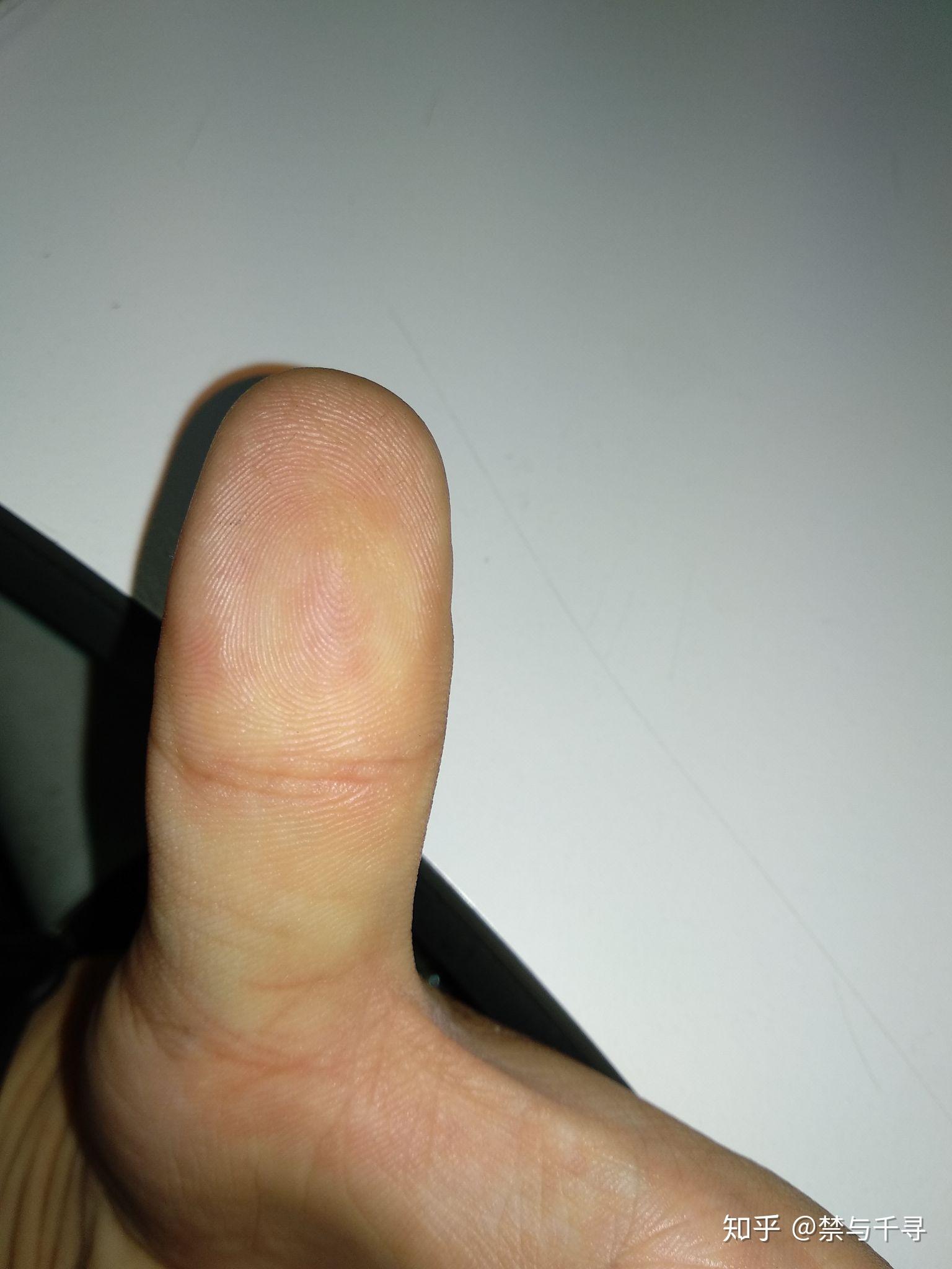 人触电了一定会死吗?