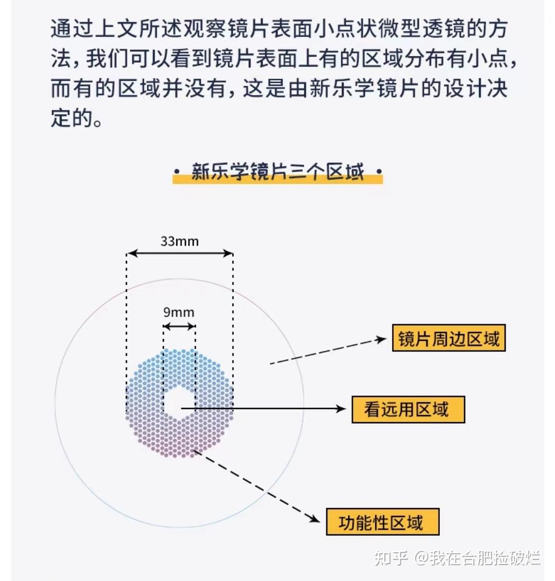 首先我们要了解一下这种离焦镜片的原理,镜片的周边区域有396个点状