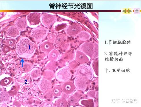 卫星细胞亦称"被囊细胞",是神经胶质细胞的一种,即神经节内包囊神经元