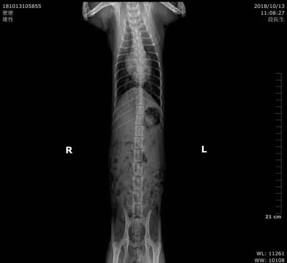 让医生听听心音,还可以加做个心脏超声(目前最好的检查手段方法),早点