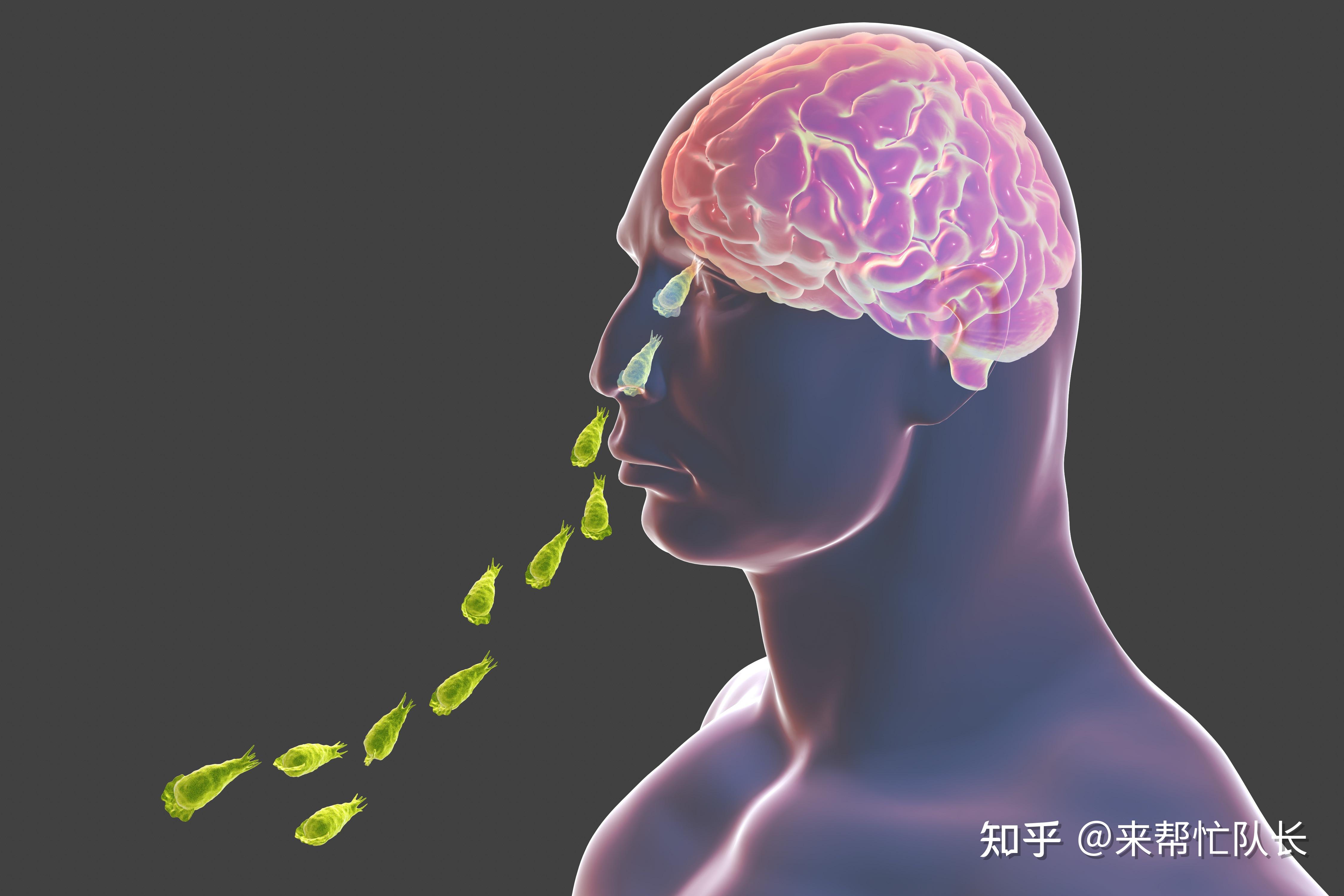 食脑虫到底是什么?被感染了有哪些征兆?