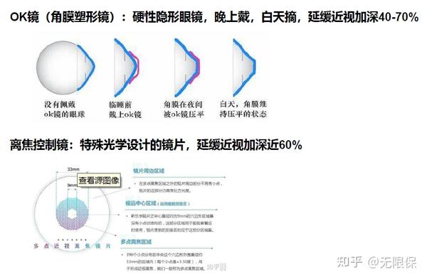 浅谈OK镜和离焦控制镜 - 知乎
