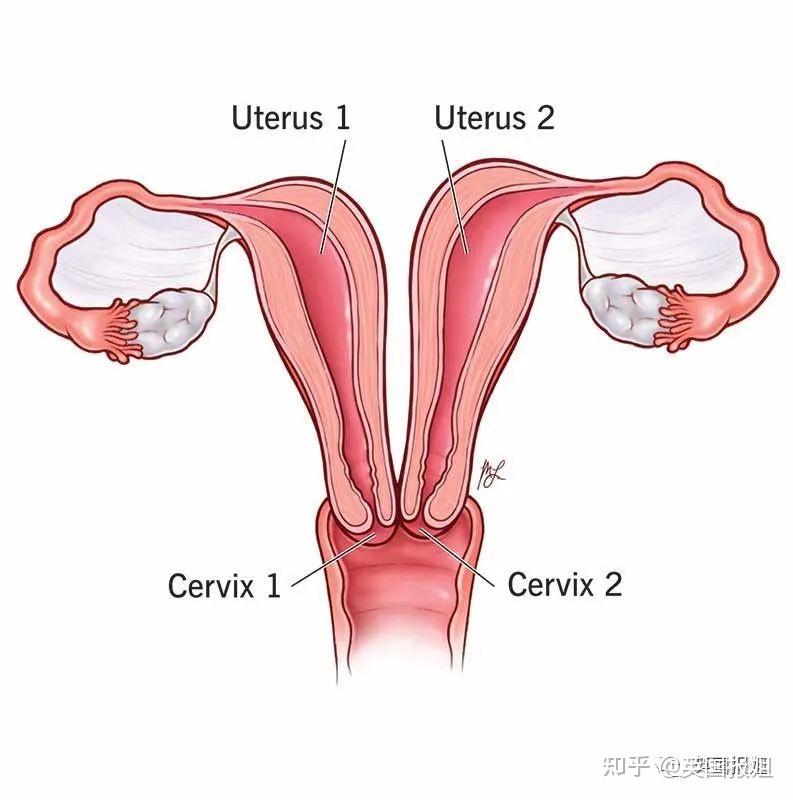 双子宫双宫颈图解图片