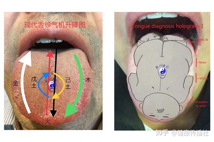 国际现代舌诊学会(英国)将大力传播舌诊新成果 - 知乎