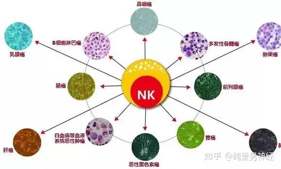 吃東西噎得慌是食道癌嗎