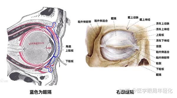 祛眼袋可以做眶隔脂肪释放术吗？ - 知乎