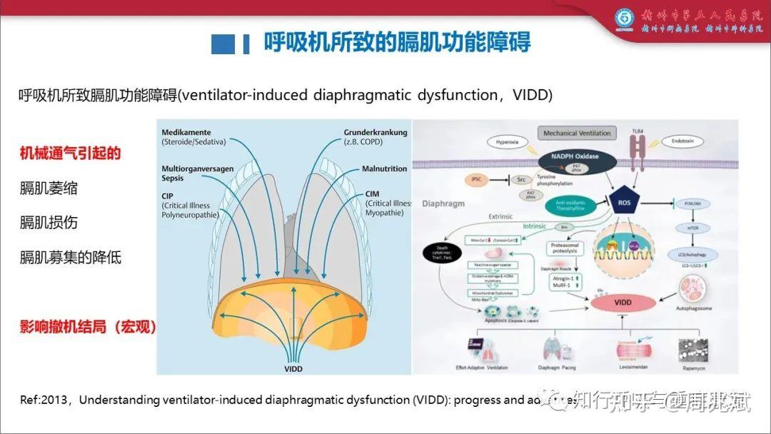 机械通气患者的吸气肌训练:循证与实践 - 知乎