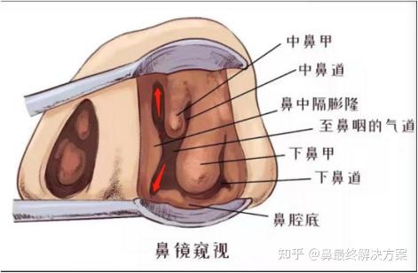 此文写给所有鼻科医生