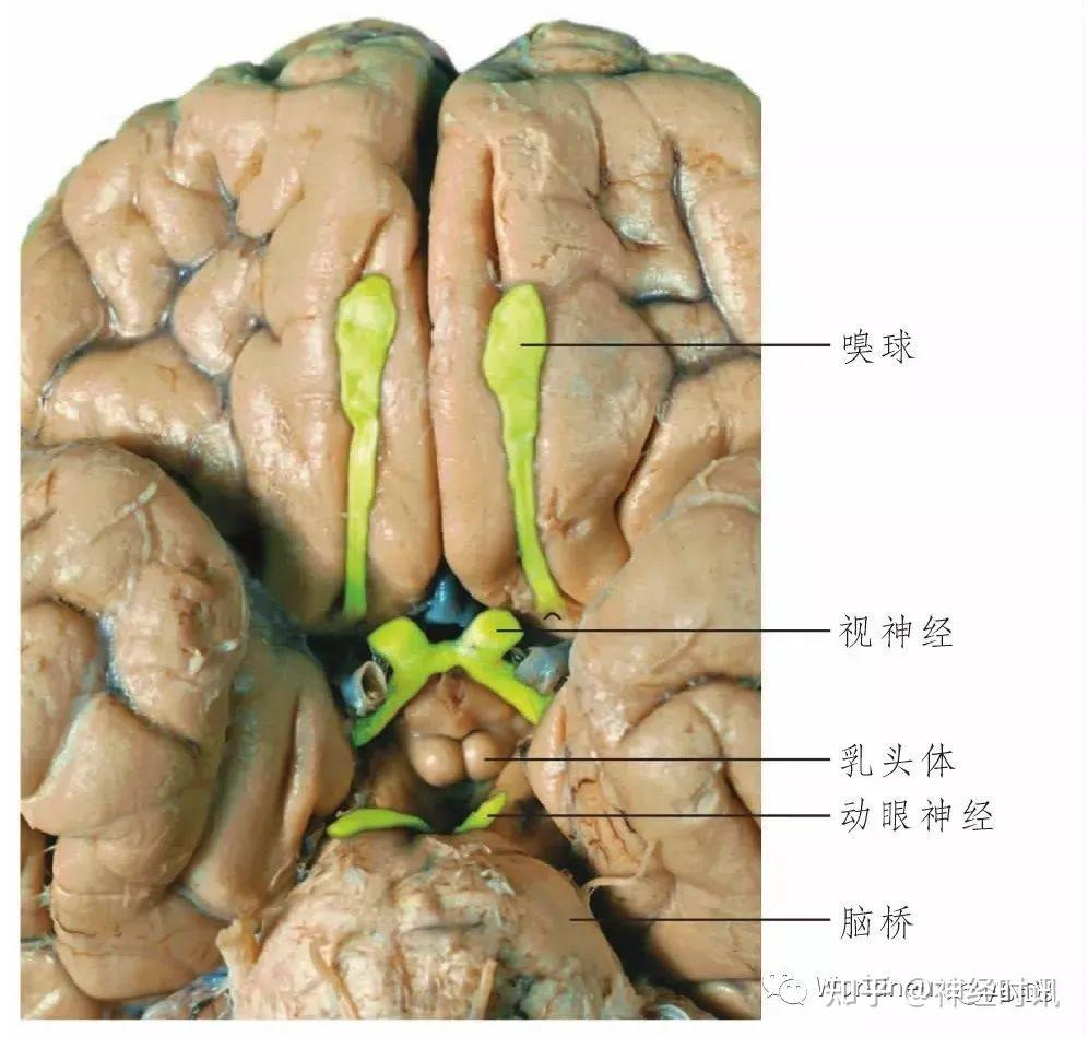 图103 中脑水平切面(经上丘)