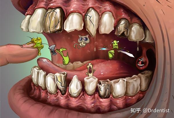 口腔菌群失调是牙齿问题的基础