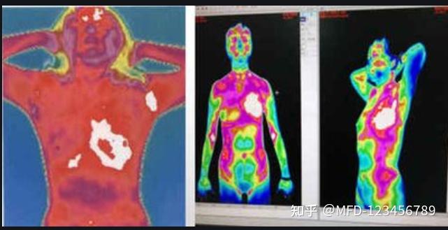 红外线穿透人体图片