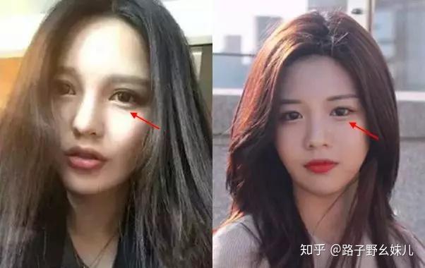 被霸凌造就的韩国最新整容模板高允真初恋颜堪比全智贤