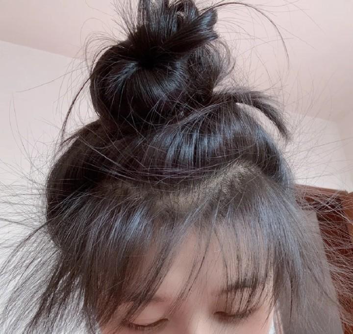 女生头发超级少,怎么才能增加发量,让头发变多? - 知乎