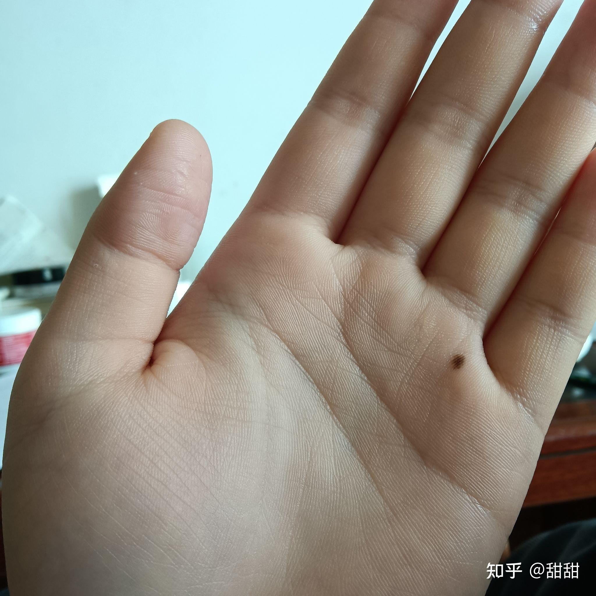 我左手手心有痣是在等什么人吗