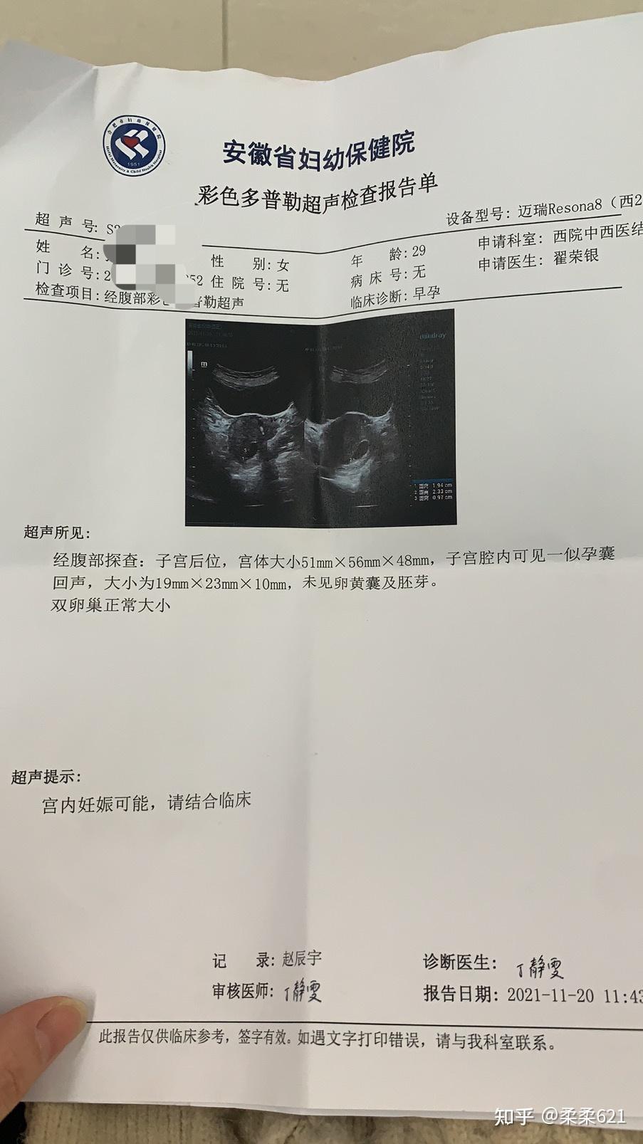 分享9周空囊药流经历