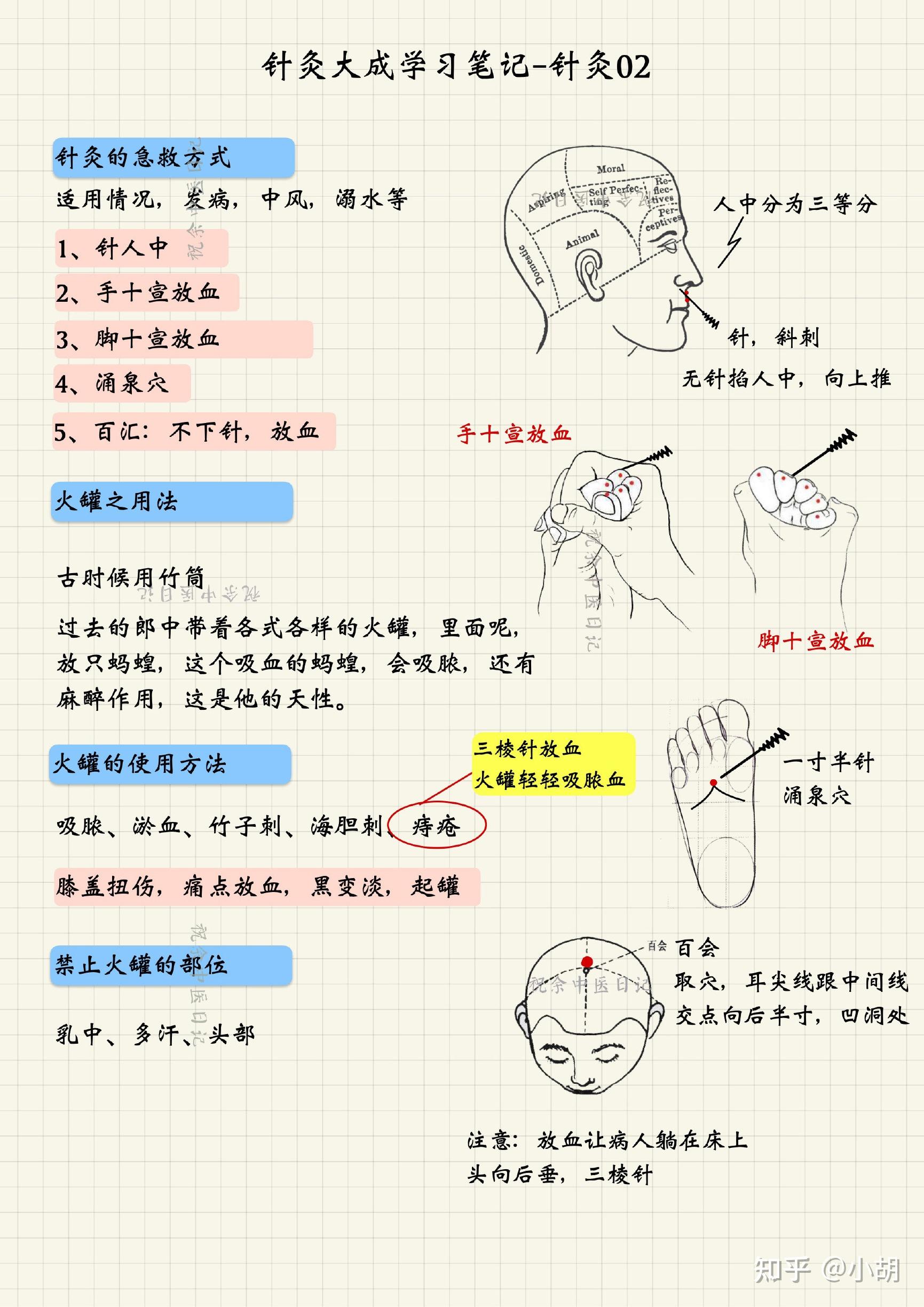 针刺图解十二刺法图片