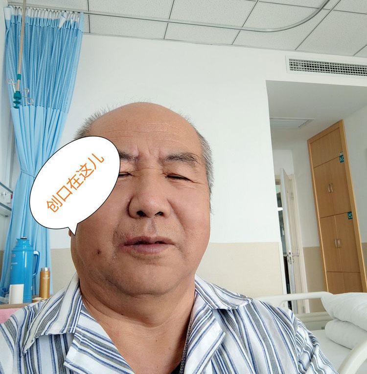 怎样才能有效的治疗三叉神经痛 v2-eed702519e37c9c5e1f1857afbea1282_1440w.jpg?source=172ae18b