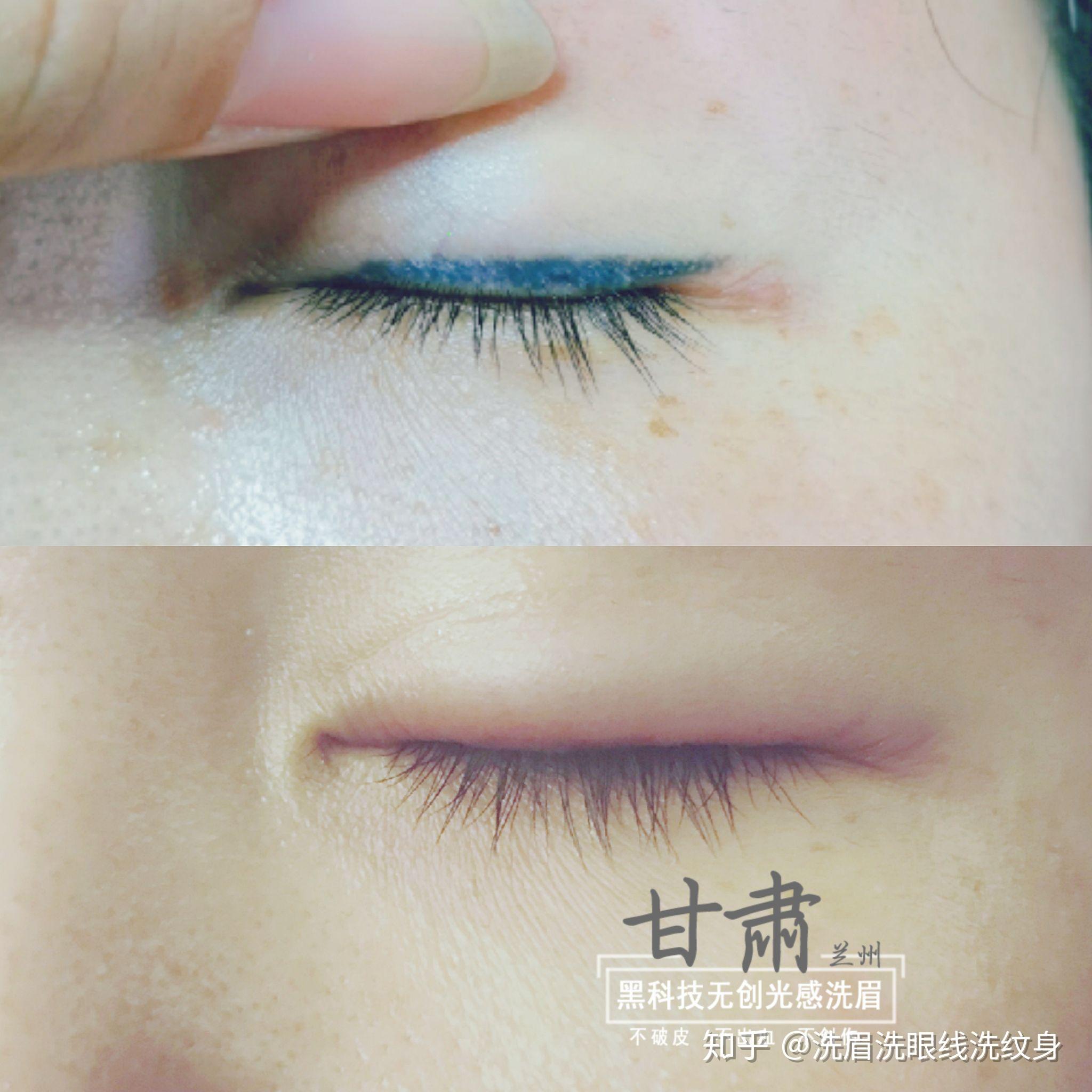 褪色了怎么办,过时了怎么办无创洗眉毛洗眼线洗纹身洗眉洗眼线洗纹身
