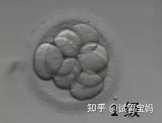 试管婴儿过程和流程