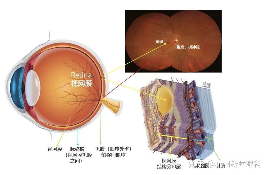 明明视力没问题却被诊断患有眼底病
