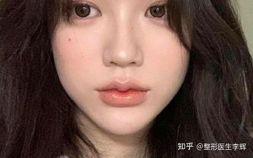 因为上嘴唇带有一颗显而易见的唇珠,从而很好地拉高了嘴型的美.