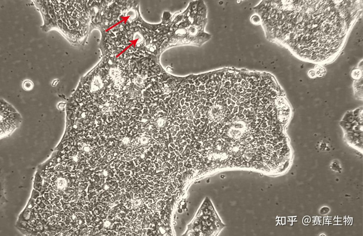 为什么细胞会出现空泡! - 知乎