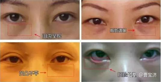 v2-efb208e45a6fdf920426933de2b71d4d_r.jpg