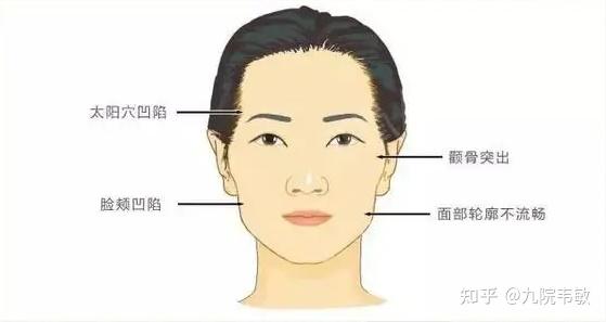 九院韦敏说,颧弓颧骨整形热门问答(一) - 知乎
