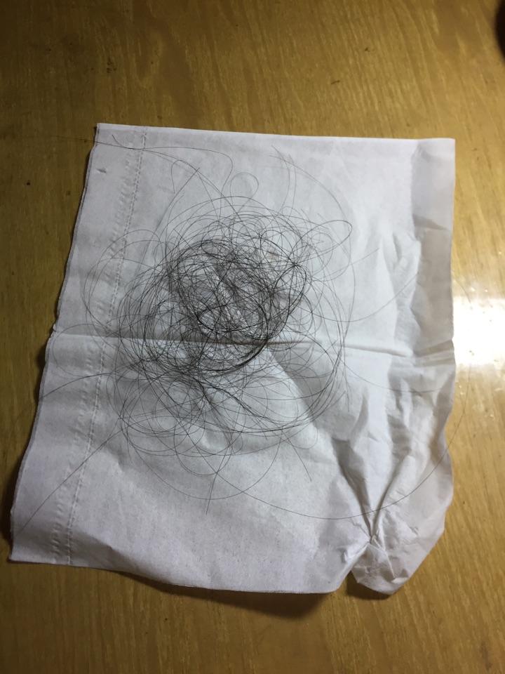 维生素B6,胱氨酸,鱼肝油一起吃可以治疗脱发吗