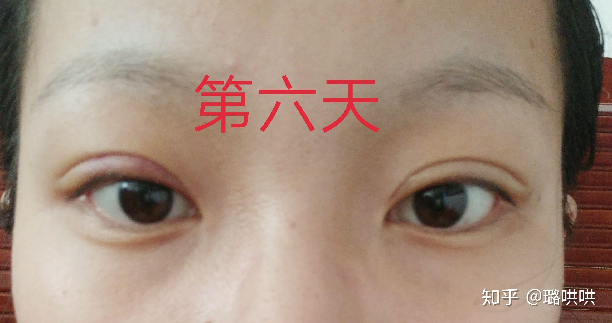 v2-f03cf3b83debf7458afc5fbff693886d_r.jpg