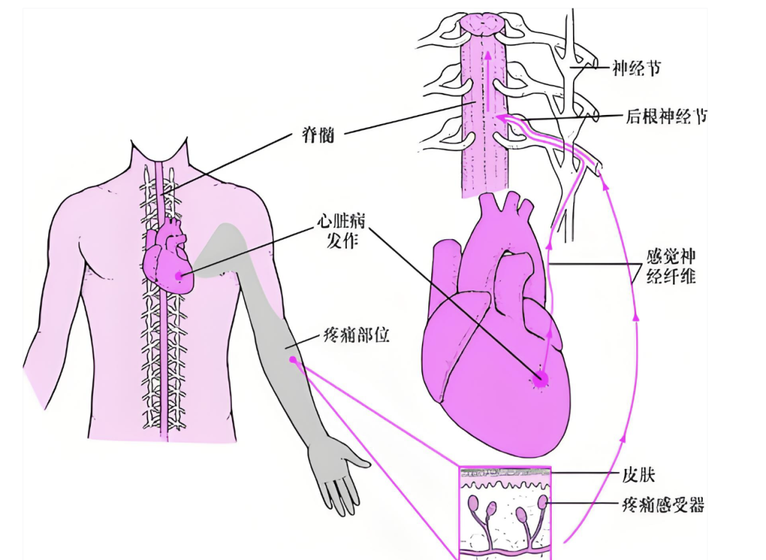 膈神经与呃逆、心前区不适 - 知乎