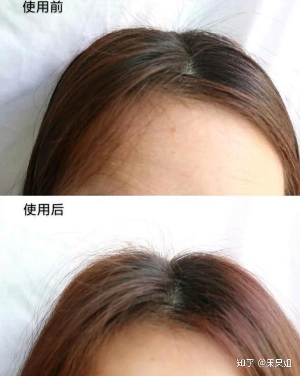 什么洗发水控油最好头发出油厉害用什么洗发水油性头发用最好的一款