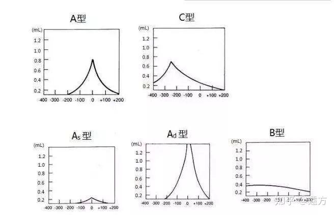 什么是声导抗测试 - 知乎