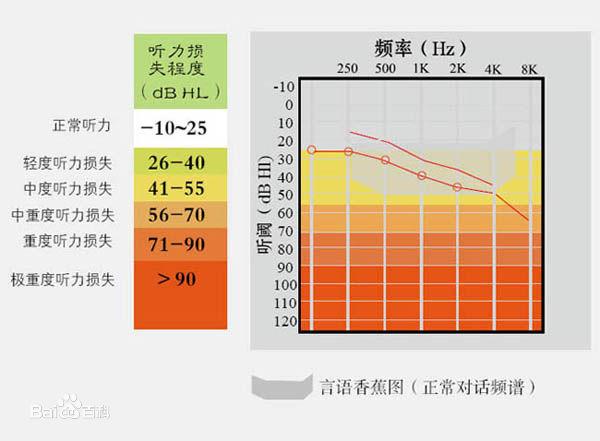 多大的噪音會造成聽力損失聽損程度的判斷標準