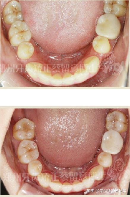 郑州牙齿矫正正畸选对医生治疗效果才有好的保障