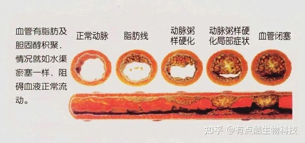 血管老化人先老!干细胞可修复损伤的血管,预防改善血管老化 - 知乎
