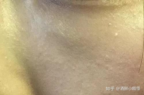 v2-f1a2bef81a62532c2f7edb2e33761979_r.jpg