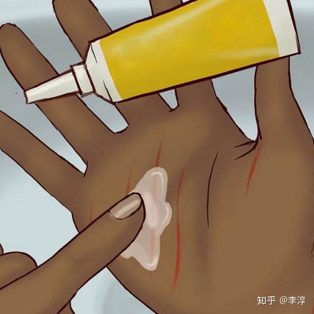 常见五种祛疤方法的利弊