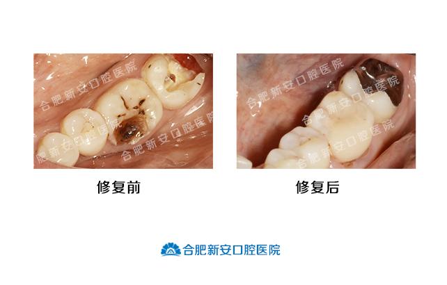 v2-f1dd5df0aa59a4b046726772dea4f729_1440w.jpg?source=172ae18b