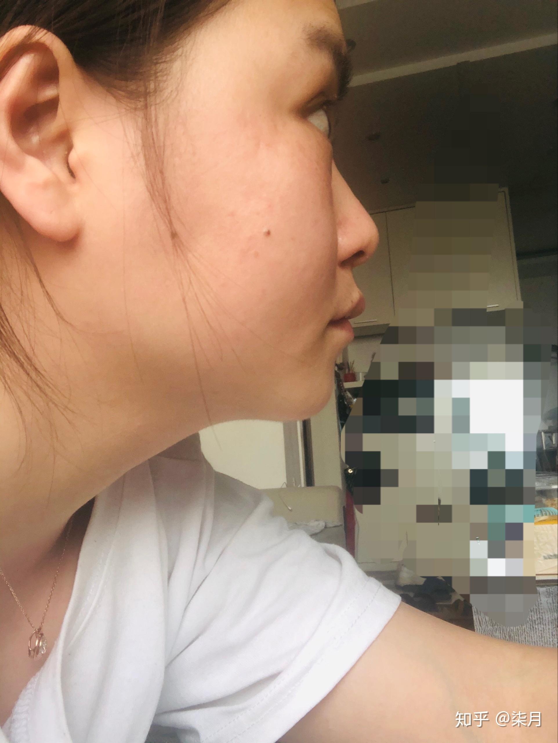 有一个超级扁平的侧脸是一种什么样的体验?