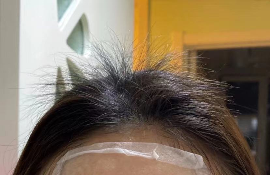 二,让头发真正浓密