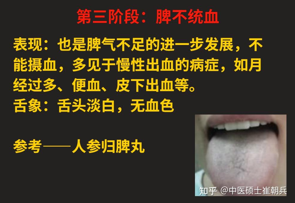 脾气虚、脾阳虚,由轻到重,看看自己的脾虚在哪个阶段?12个阶段的脾虚一次讲明白 - 知乎